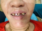 Đặng Thị Ấm 
