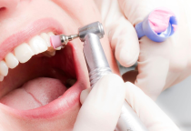 Kinh Nghiệm Cạo Vôi Răng Và Đánh Bóng Răng – Bí Quyết Cho Nụ Cười Tươi Tại Nha Khoa Tân Tiến