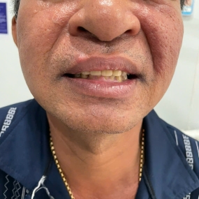 Nguyễn Văn Phú 