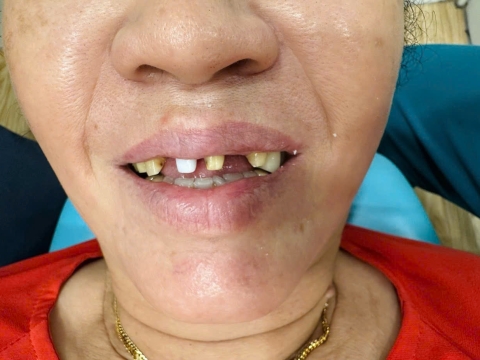 Đặng Thị Ấm 