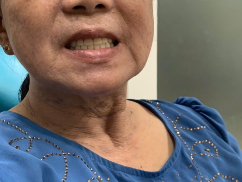 Vợ chú 8 Khôi