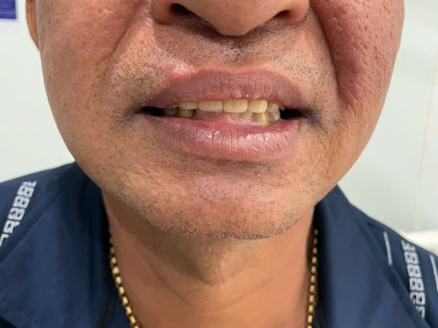 Nguyễn Văn Phú 