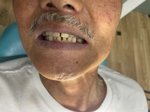 Huỳnh Văn Nhỏ 
